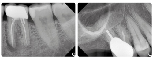 EzSensor Classic Радиовизиограф с принадлежностями, в комплекте 5 лицензий ПО Vatech (Ю. Корея) фото 4