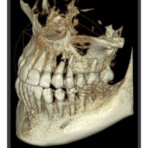 RAYSCAN Symphony Alpha 3D  Ортопантомограф с томографом, 3D 9х9 см Ray Co Ltd (Ю. Корея) фото 4