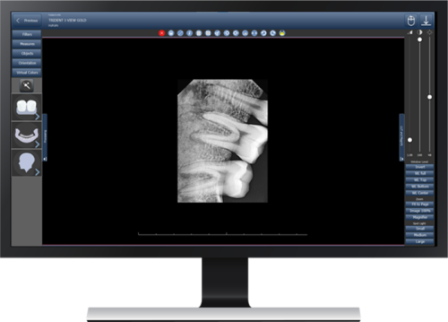 I-View Gold цифровой радиовизиограф Trident (Италия) фото 3