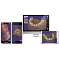 Exocad 2018 Valletta   программное обеспечение для компьютерного моделирования стоматологических реставраций